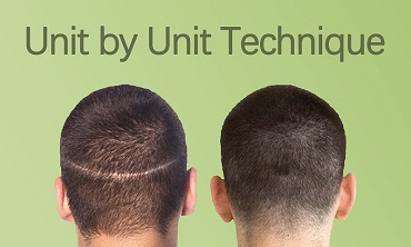 Unit by Unit Technique