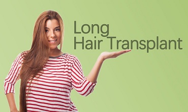 Long Hair Transplant