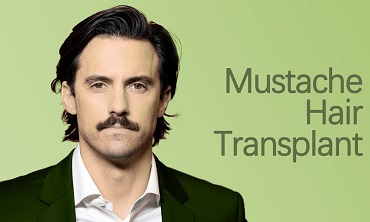 Mustache Hair Transplant