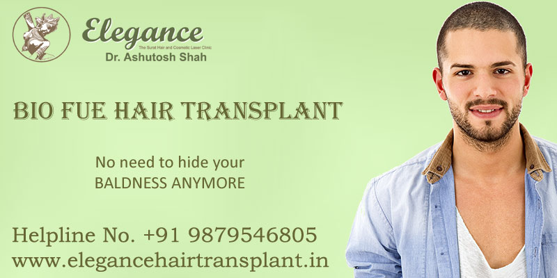BIO-FUE Hair Transplantation in Surat - Elegance Clinic