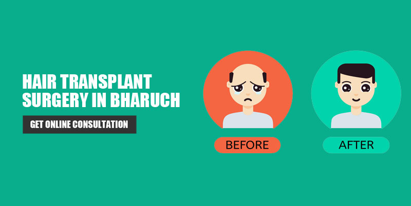 Hair Transplant Bharuch