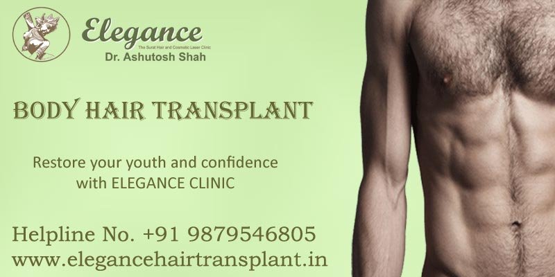 body hair transplant