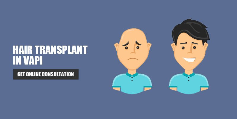 Hair Transplant Vapi