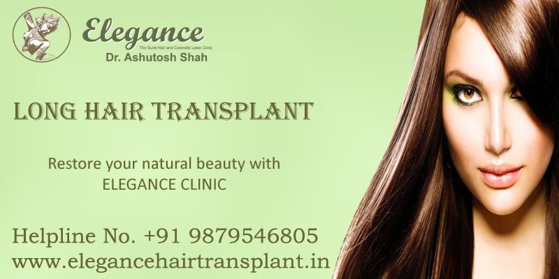 long hair transplant