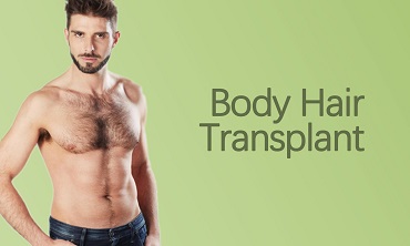 Body Hair Transplantation