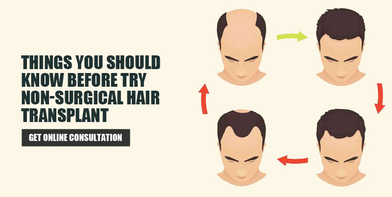 Things You Should Know Before Try Non-Surgical Hair Transplant - Elegance  Clinic