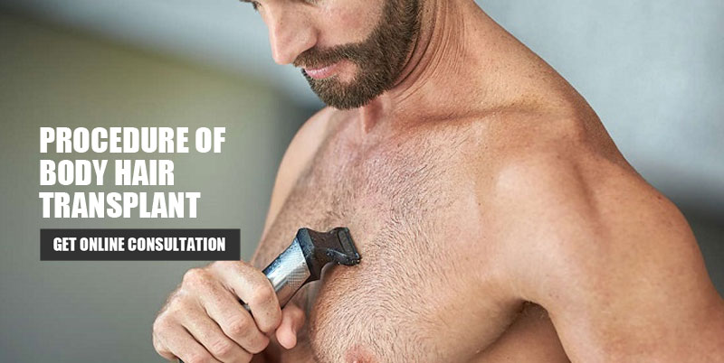 What is the Procedure of Body Hair Transplant - Elegance Clinic